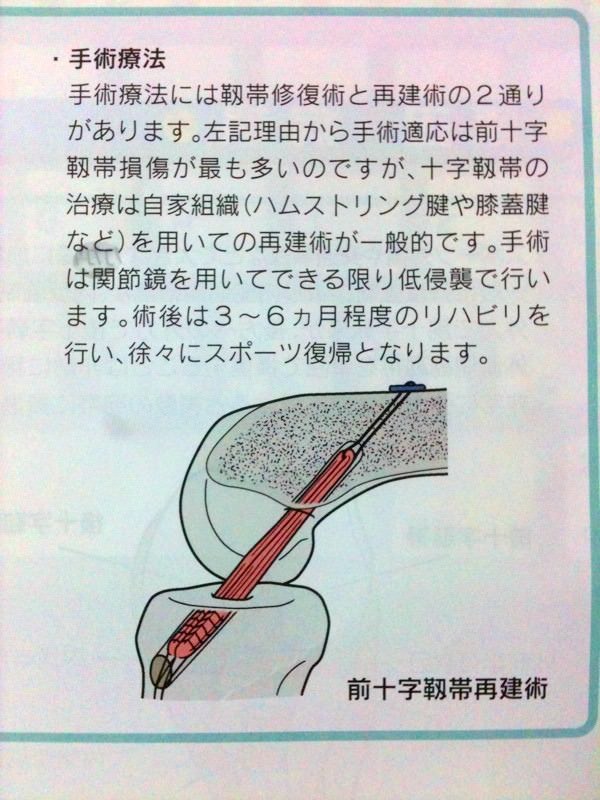 前十字靭帯再建術